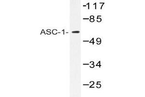 Western blot (WB) analysis of ASC-1 antibody in extracts from K562 cells. (TRIP4 anticorps)