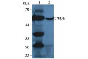 Western blot analysis of (1) Mouse Liver Tissue and (2) Mouse Liver Tissue. (CYP2E1 anticorps  (AA 34-273))
