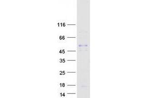 Chemokine (C-C Motif) Ligand 18 (Pulmonary and Activation-Regulated) (CCL18) protein (Myc-DYKDDDDK Tag)