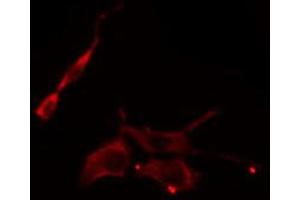 ABIN6274832 staining COLO205 cells by IF/ICC.