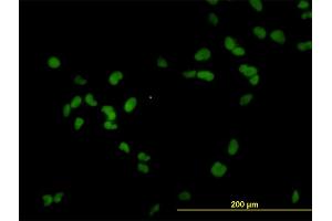 Immunofluorescence of monoclonal antibody to RCC1 on HeLa cell.