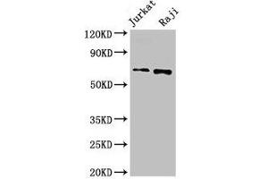 Western Blot Positive WB detected in: Jurkat whole cell lysate, Raji whole cell lysate All lanes: CDC6 antibody at 2. (CDC6 anticorps  (AA 1-141))