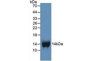 Detection of Recombinant bTG, Human using Monoclonal Antibody to Chemokine (C-X-C motif) ligand 7 ( CXCL7) (CXCL7 anticorps  (AA 59-128))