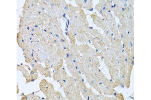 Immunohistochemistry of paraffin-embedded Rat heart using GPLD1 Polyclonal Antibody at dilution of 1:100 (40x lens). (GPLD1 anticorps)