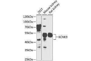 Western blot analysis of extracts of various cell lines, using KCNK9 antibody  at 1:1000 dilution. (KCNK9 anticorps  (AA 1-100))