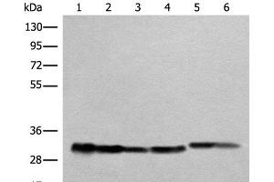 Western blot analysis of Human heart tissue A549 231 Jurkat HEPG2 and Hela cell lysates using ATP5C1 Polyclonal Antibody at dilution of 1:1000 (ATP5C1 anticorps)
