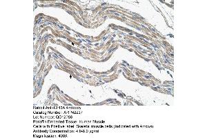 Rabbit Anti-IDH3A Antibody  Paraffin Embedded Tissue: Human Muscle Cellular Data: Skeletal muscle cells Antibody Concentration: 4.