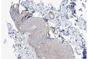 ABIN6266983 at 1/100 staining human skin tissue sections by IHC-P. (MAST4 anticorps  (N-Term))