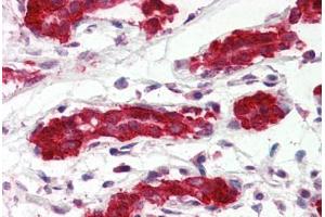 Human Breast (formalin-fixed, paraffin-embedded) stained with PDCD4 antibody ABIN364343 at 5 ug/ml followed by biotinylated anti-mouse IgG secondary antibody ABIN481714, alkaline phosphatase-streptavidin and chromogen. (PDCD4 anticorps  (AA 1-469))