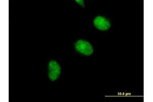 Immunofluorescence of purified MaxPab antibody to CDCA5 on HeLa cell. (CDCA5 anticorps  (AA 1-252))