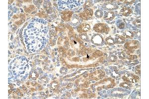 SPTLC1 antibody was used for immunohistochemistry at a concentration of 4-8 ug/ml. (SPTLC1 anticorps  (Middle Region))