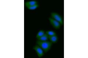 Detection of S100A6 in Human MCF7 cell using Polyclonal Antibody to S100 Calcium Binding Protein A6 (S100A6) (S100A6 anticorps  (AA 1-90))