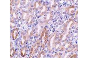 Immunohistochemistry of CAD in mouse kidney tissue with CAD antibody at 1 μg/ml.