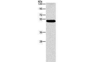 Western Blot analysis of Human lung cancer tissue using CALCRL Polyclonal Antibody at dilution of 1:550 (CALCRL anticorps)