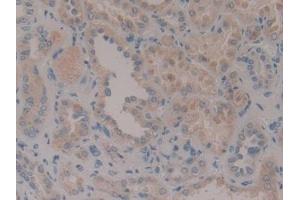 Detection of CENPF in Human Kidney Tissue using Polyclonal Antibody to Centromere Protein F (CENPF) (CENPF anticorps  (AA 436-637))