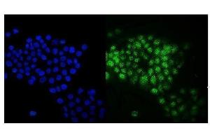 IF analysis of Rab9/RAB9A using anti-Rab9/RAB9A antibody (ABIN7601611). (RAB9A anticorps  (AA 4-171))