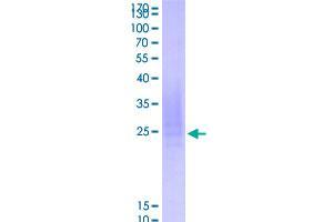 Image no. 1 for B-cell antigen receptor complex-associated protein alpha chain (CD79A) (AA 33-143) protein (His-DYKDDDDK-Strep II Tag) (ABIN2752752)