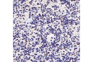 Immunohistochemistry analysis of paraffin-embedded mouse spleen using ADRA1B (ABIN7072974) at dilution of 1: 1200 (ADRA1B anticorps)