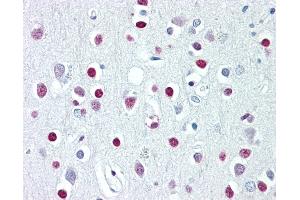 Anti-WHSC1 / NSD2 antibody IHC of human brain, cortex. (WHSC1 anticorps  (AA 219-268))