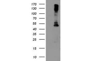 Western Blotting (WB) image for anti-Lipoprotein Lipase (LPL) (AA 28-475) antibody (ABIN1491318)