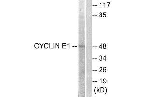 Western Blotting (WB) image for anti-Cyclin E1 (CCNE1) (Thr395) antibody (ABIN1847908) (Cyclin E1 anticorps  (Thr395))
