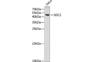 Western blot analysis of extracts of HeLa cells, using SDC2 antibody (ABIN3022587, ABIN3022588, ABIN3022589 and ABIN6218928) at 1:1000 dilution. (Syndecan 2 anticorps  (AA 19-144))