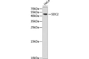 Western blot analysis of extracts of HeLa cells, using SDC2 antibody (ABIN3022587, ABIN3022588, ABIN3022589 and ABIN6218928) at 1:1000 dilution. (Syndecan 2 anticorps  (AA 19-144))
