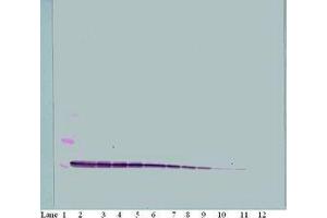 Image no. 1 for anti-Chemokine (C-X-C Motif) Ligand 10 (CXCL10) antibody (ABIN465012) (CXCL10 anticorps)