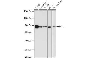 Western blot analysis of extracts of various cell lines, using SYT1 antibody (ABIN3021249, ABIN3021250, ABIN3021251 and ABIN6214085) at 1:1000 dilution.