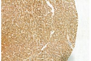 ABIN6262995 and ABIN6272963 at 1/100 staining Human normal tissues adjacent to liver cancer by IHC-P. (LONP1 anticorps  (C-Term))