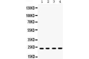 Western blot analysis of Rab9 expression in rat brain extract (lane 1), mouse brain extract (lane 2), HELA whole cell lysates (lane 3) and MCF-7 whole cell lysates (lane 4). (RAB9A anticorps  (C-Term))