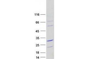 Validation with Western Blot