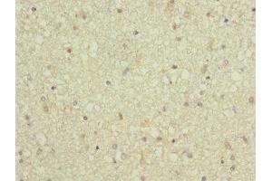 Immunohistochemistry of paraffin-embedded human brain tissue using ABIN7143097 at dilution of 1:100