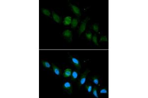 Immunofluorescence analysis of U2OS cell using HLA-A antibody. (HLA-A anticorps  (AA 35-285))
