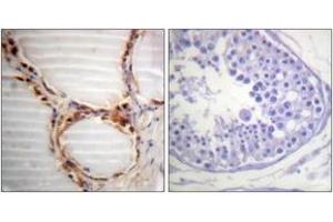 Immunohistochemistry analysis of paraffin-embedded human testis tissue, using MCM4 (Ab-54) Antibody.
