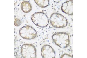 Immunohistochemistry of paraffin-embedded human colon using NFU1 antibody at dilution of 1:200 (40x lens). (NFU1 anticorps)