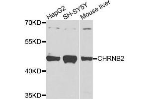 Western blot analysis of extracts of various cells, using CHRNB2 antibody. (CHRNB2 anticorps)