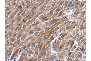 IHC-P Image Immunohistochemical analysis of paraffin-embedded U87 xenograft, using BAG2, antibody at 1:500 dilution.