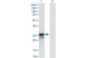 Western Blot analysis of DIRAS2 expression in transfected 293T cell line by DIRAS2 polyclonal antibody (A01).
