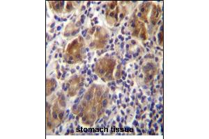 anti-Melanophilin (MLPH) (AA 541-569), (C-Term) antibody