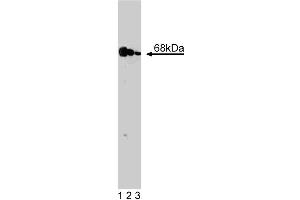 Western blot analysis of PKR on a A431 cell lysate (Human epithelial carcinoma, ATCC CRL-1555). (EIF2AK2 anticorps  (AA 117-250))