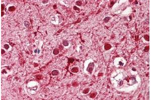 Image no. 2 for anti-Achaete-Scute Complex Homolog 3 (ASCL3) (AA 118-130) antibody (ABIN1495987) (ASCL3 anticorps  (AA 118-130))