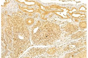 ABIN6261610 and ABIN6269080 at 1/100 staining Rat ovary tissue by IHC-P. (Estrogen Receptor alpha anticorps  (C-Term))