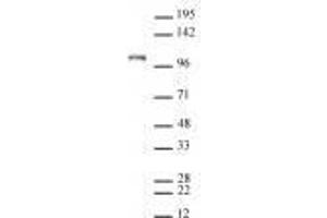 Mili / PiwiL2 antibody (rAb) tested by Western blot. (Recombinant PIWIL2 anticorps)