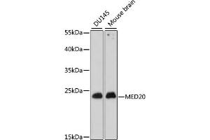 Western blot analysis of extracts of various cell lines, using MED20 antibody (ABIN7268441) at 1:1000 dilution. (MED20 anticorps  (AA 1-212))