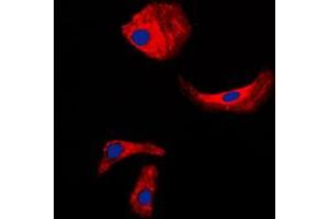 Immunofluorescent analysis of Kallikrein 3 staining in LNCaP cells.