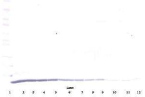 Image no. 1 for anti-Chemokine (C-C Motif) Ligand 22 (CCL22) antibody (ABIN465131) (CCL22 anticorps)