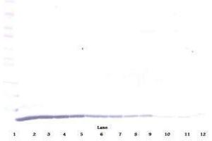 Image no. 1 for anti-Chemokine (C-C Motif) Ligand 22 (CCL22) antibody (ABIN465130) (CCL22 anticorps)
