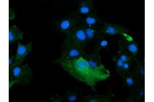 Image no. 4 for anti-Kallikrein 8 (KLK8) antibody (ABIN1498969)