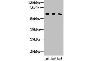 Western blot All lanes: KLHL23 antibody at 3 μg/mL Lane 1: Mouse lung tissue Lane 2: Human placenta tissue Lane 3: HL60 whole cell lysate Secondary Goat polyclonal to rabbit IgG at 1/10000 dilution Predicted band size: 64 kDa Observed band size: 64 kDa (KLHL23 anticorps  (AA 1-200))